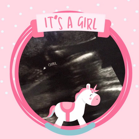 It’s a girl ?