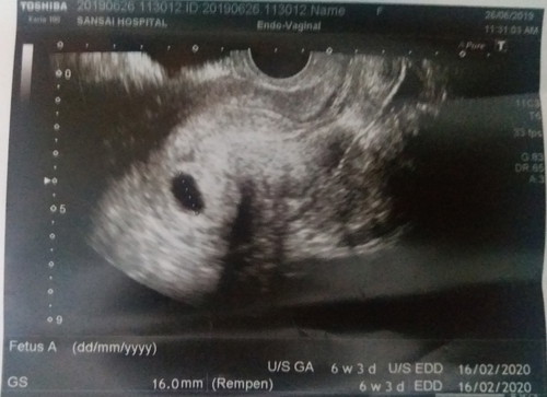 ตั้งครรภ์?