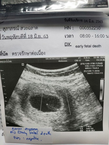 น้องหัวใจไม่เต้น