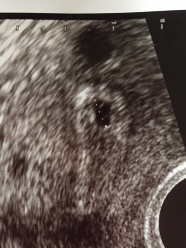 5w 3 d