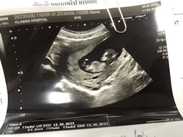 Anchalee Yuadying profile icon