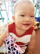 ตุ่มยุงกัด