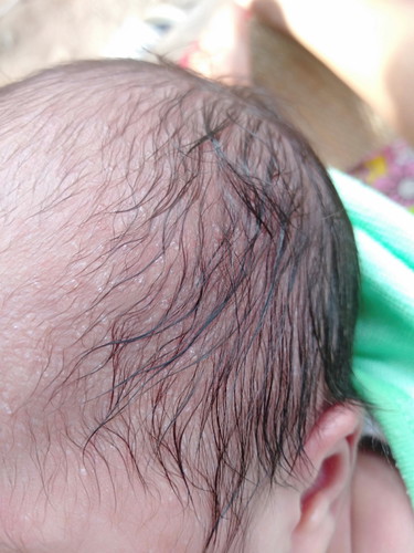 ลูก