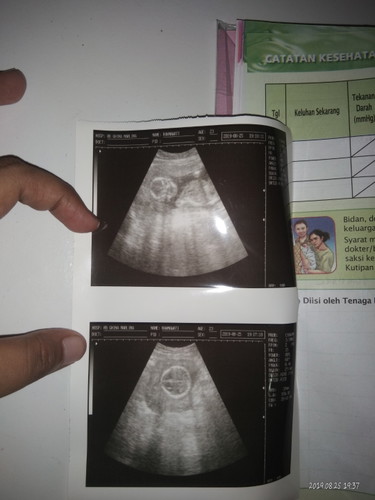haii bunda²