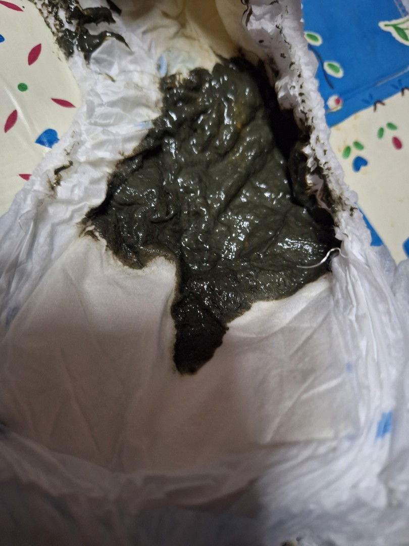 อึแบบนี้ปกติไหมค่ะ