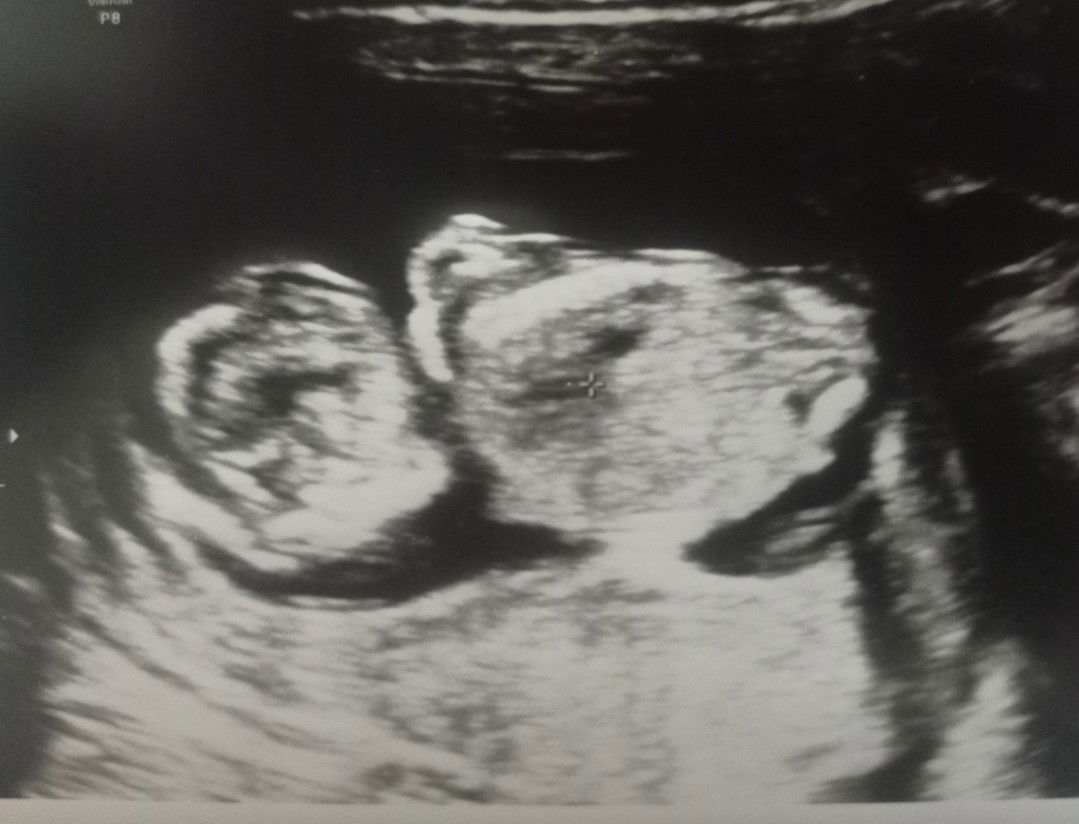 ibu cibul profile icon