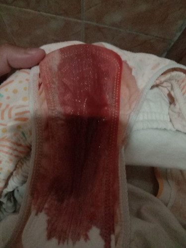 dugo