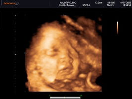 อโณทัย ชื่นอารมย์ profile icon