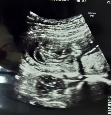 ลูกสาวของแม่ ?