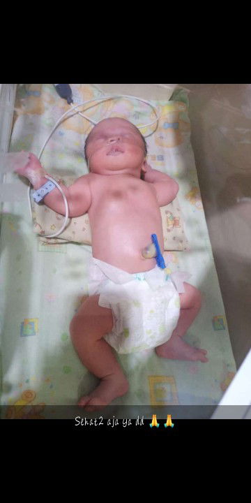 sesek nafas selesai operasi sc