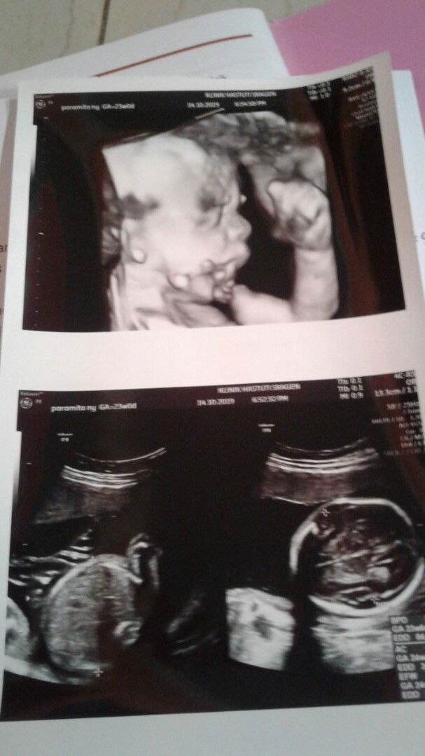 bahagia q milik bersama