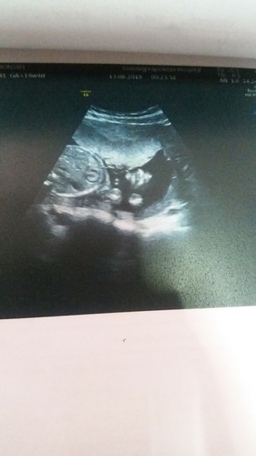 เพศลูก