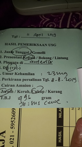 cemas saat persalinan