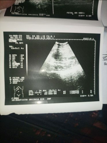 Crishia Mie Bautista profile icon