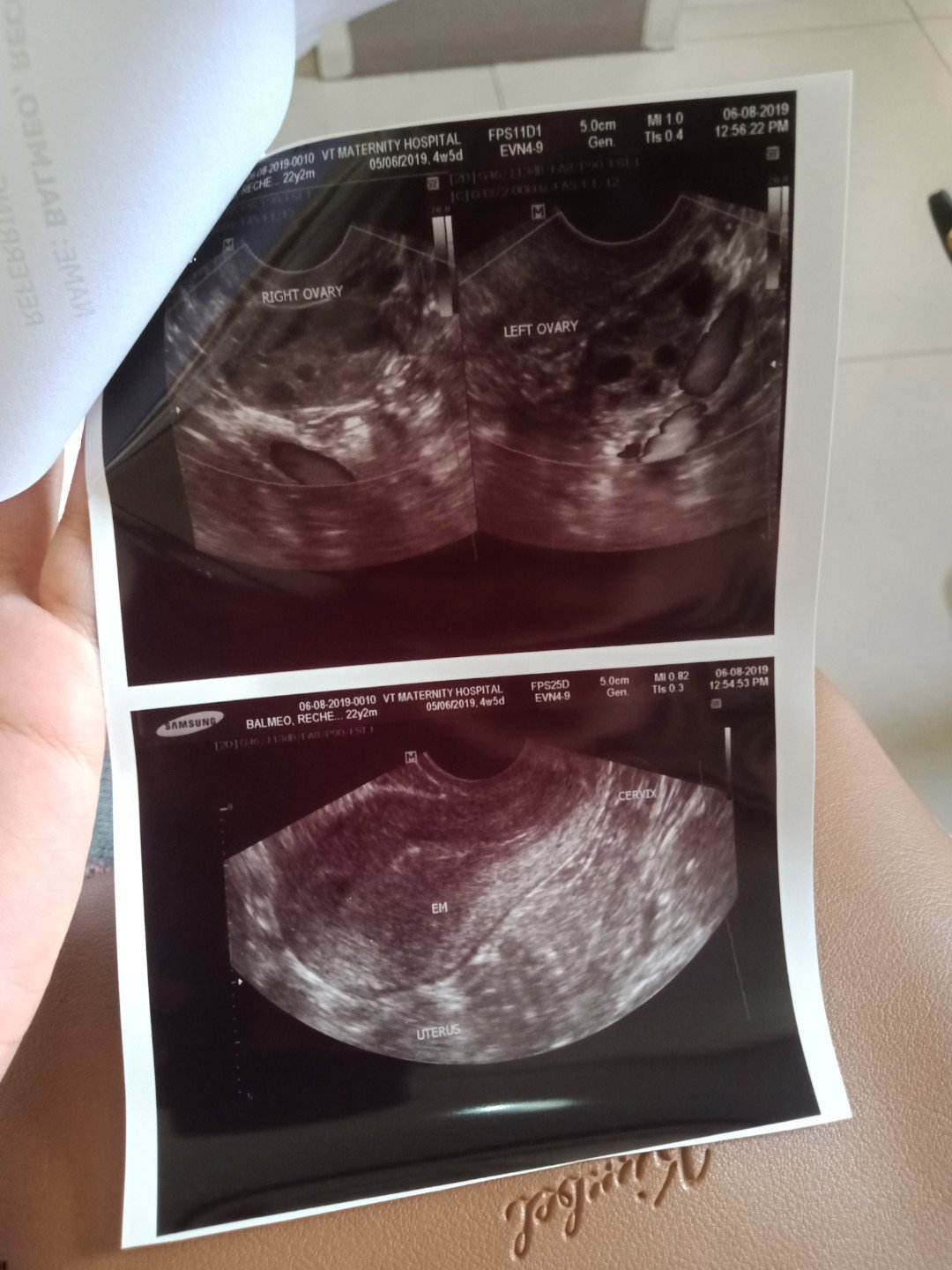 First Baby???