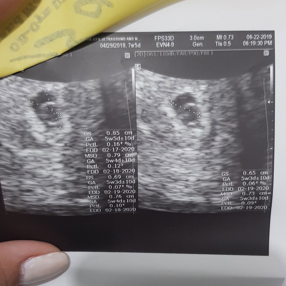 How i gain my angel in Heaven..