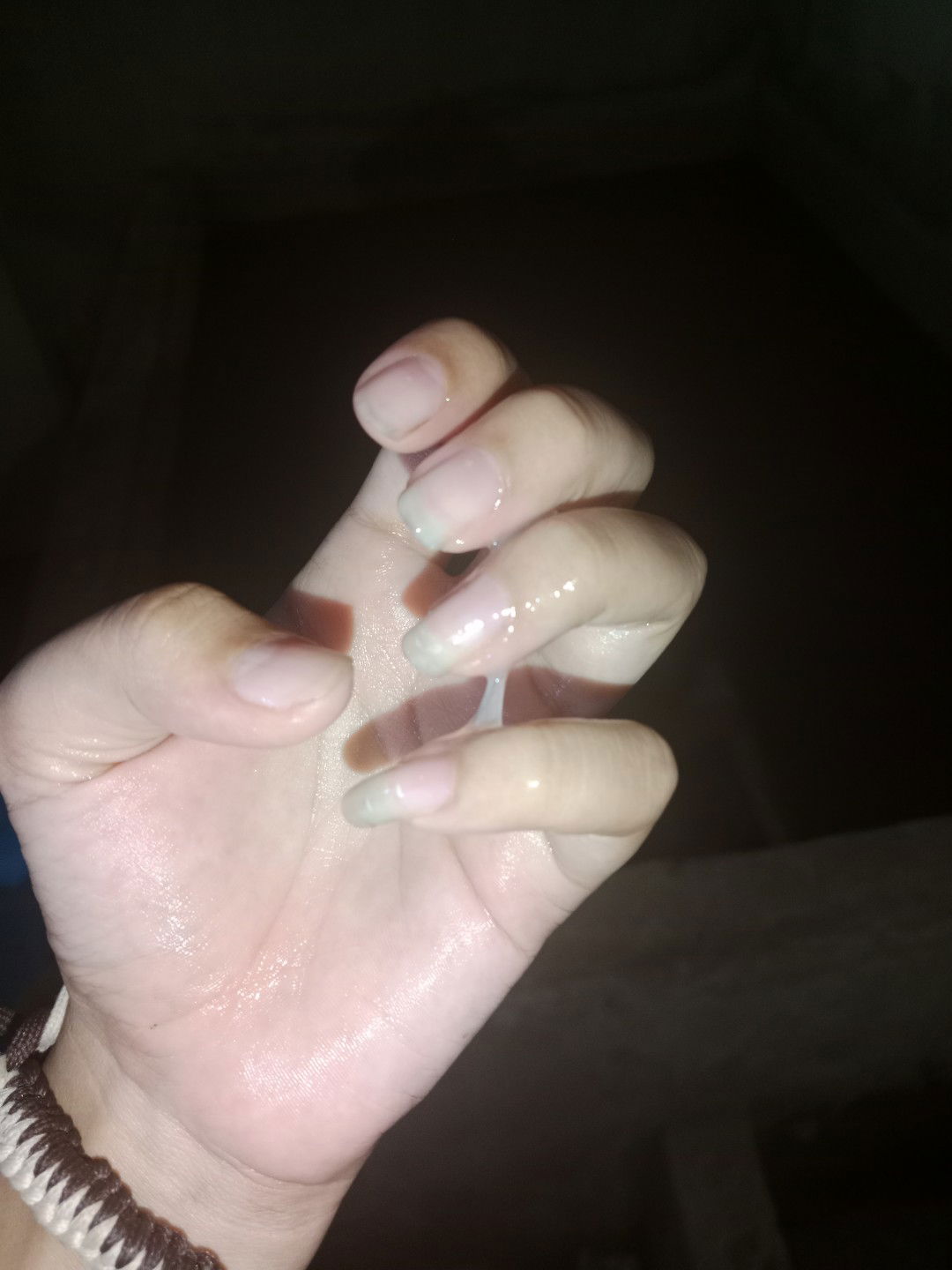 มูกใสเหนียวตอน24สัปดา6วัน