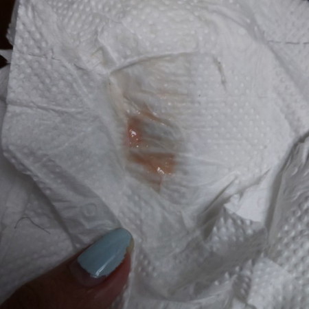 37 weeks and 4 days.