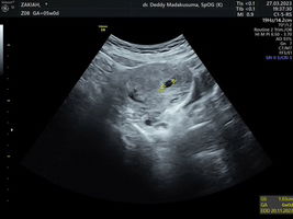 Zakiah Zarkasi profile icon