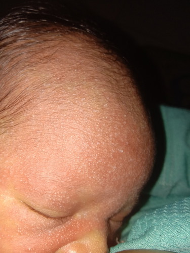 bayi