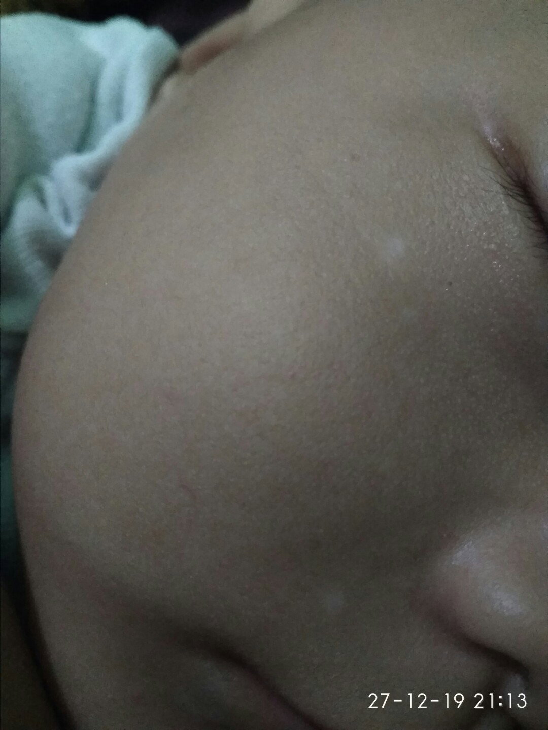 Bercak Putih