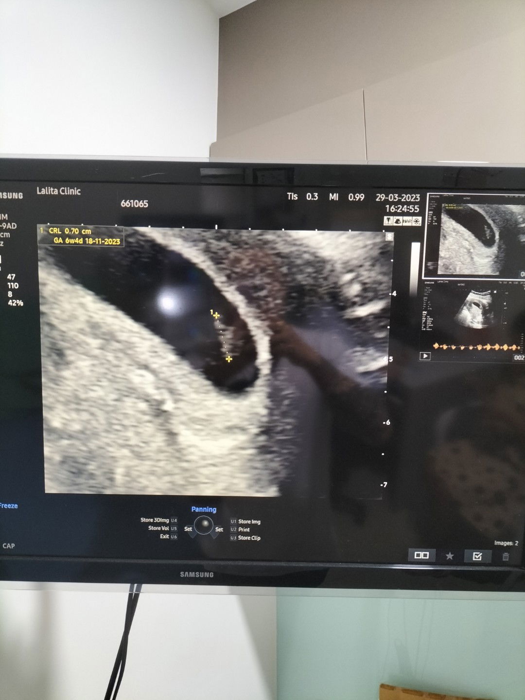 Kannika Mekarkad profile icon