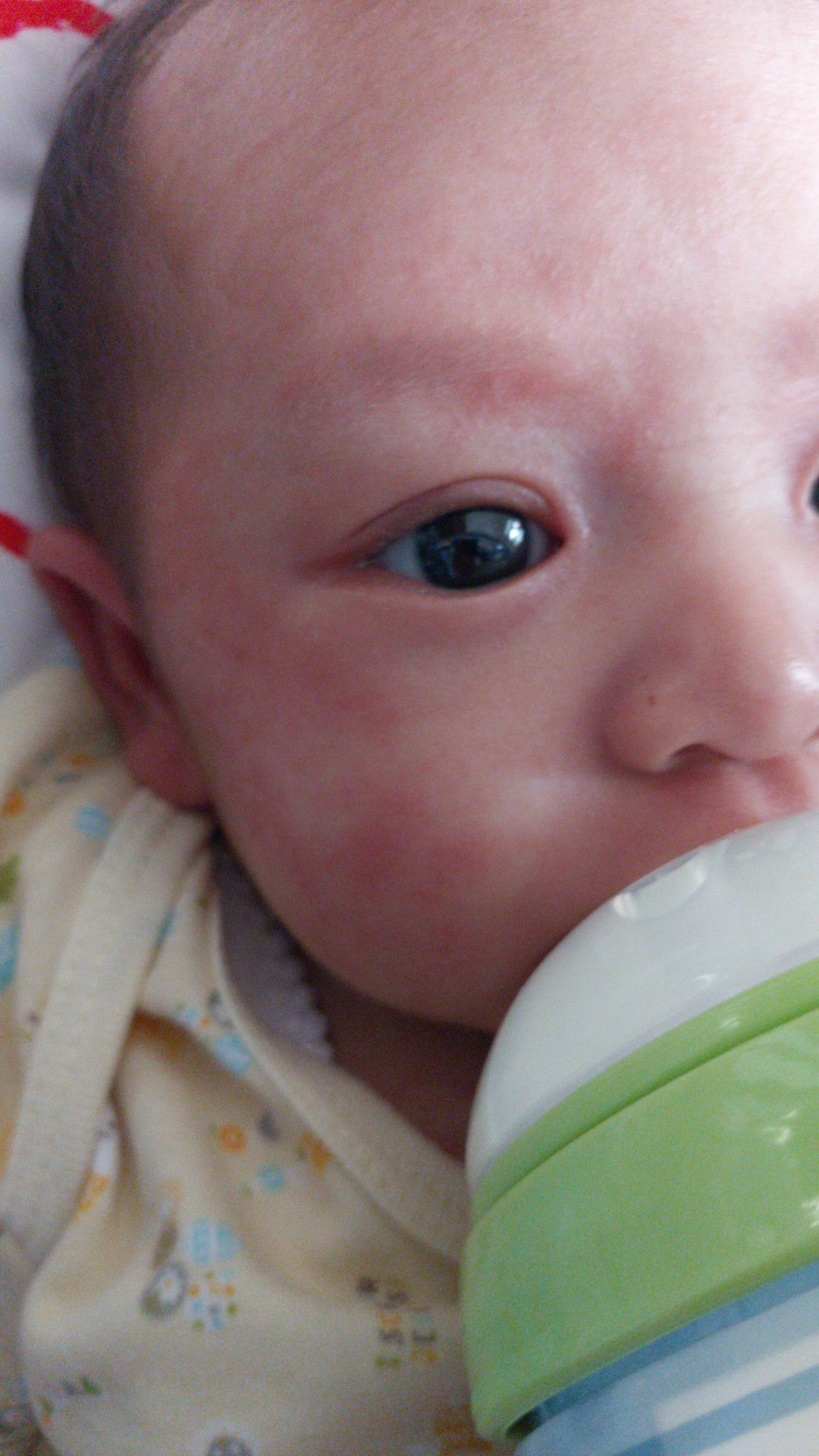 Baby ku terkena staphylococcal scalded skin syndrome (SSSS)