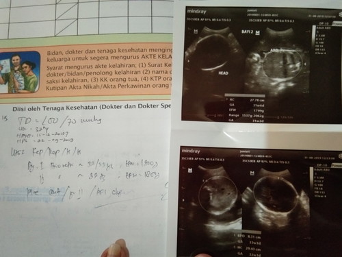 32 apa 33w?