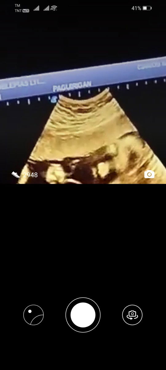 Anonymous profile icon