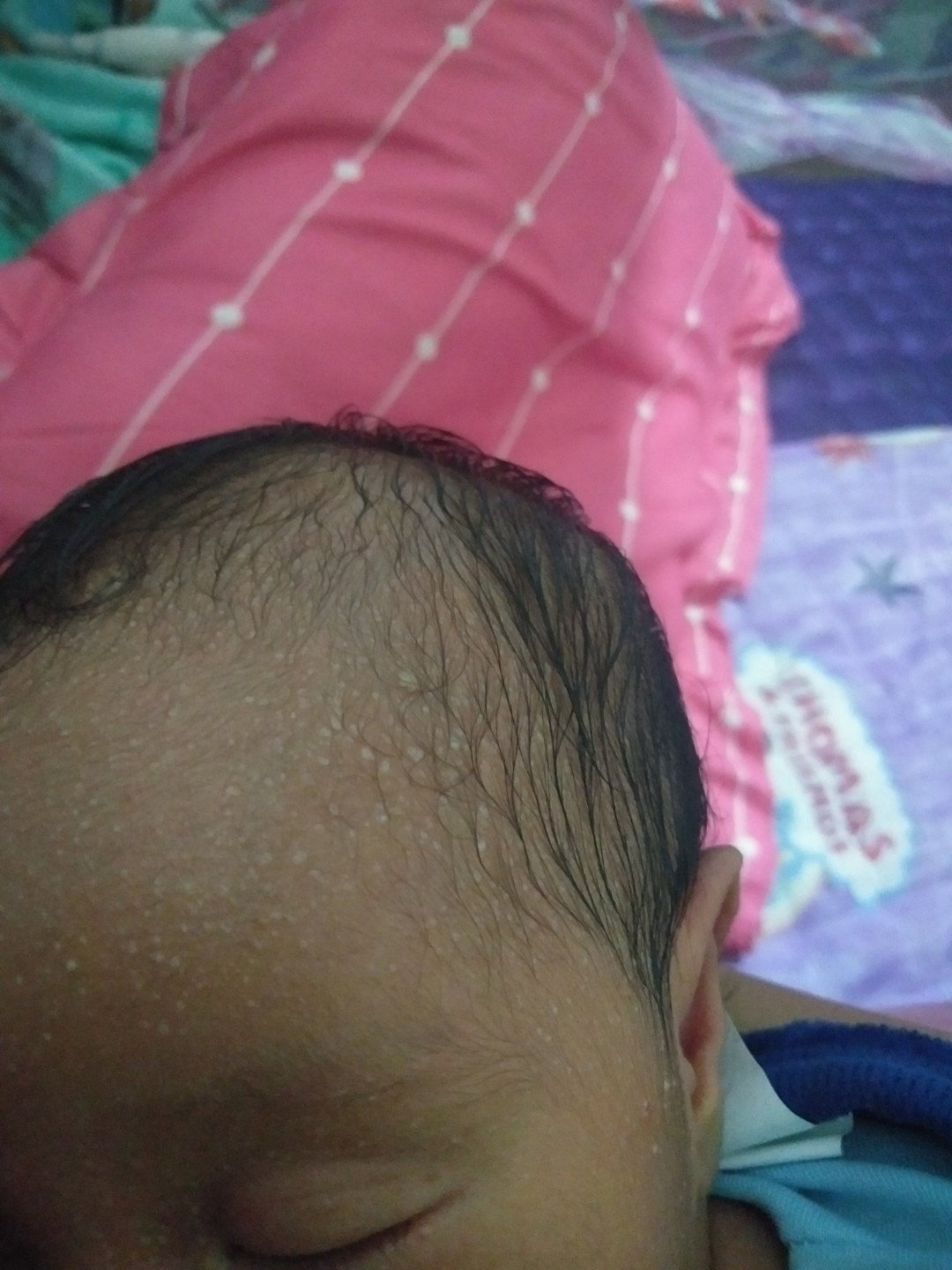 bintik2 putih berisi air