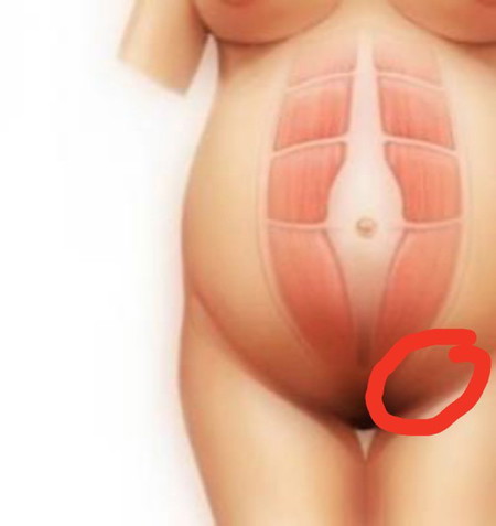 ปวดท้อง