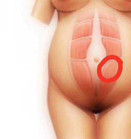 เจ็บจี๊ดๆตรงนี้