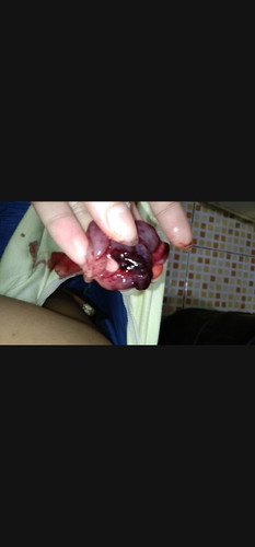ILANG WEEKS NAKONG DINUDUGO