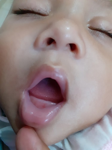 tumbuh gigi