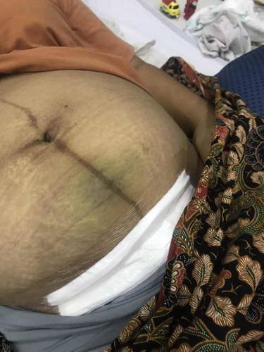 กังวลค่ะ