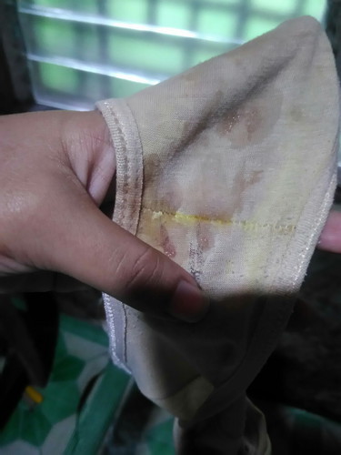 Brown Blood or Dugo ba to?