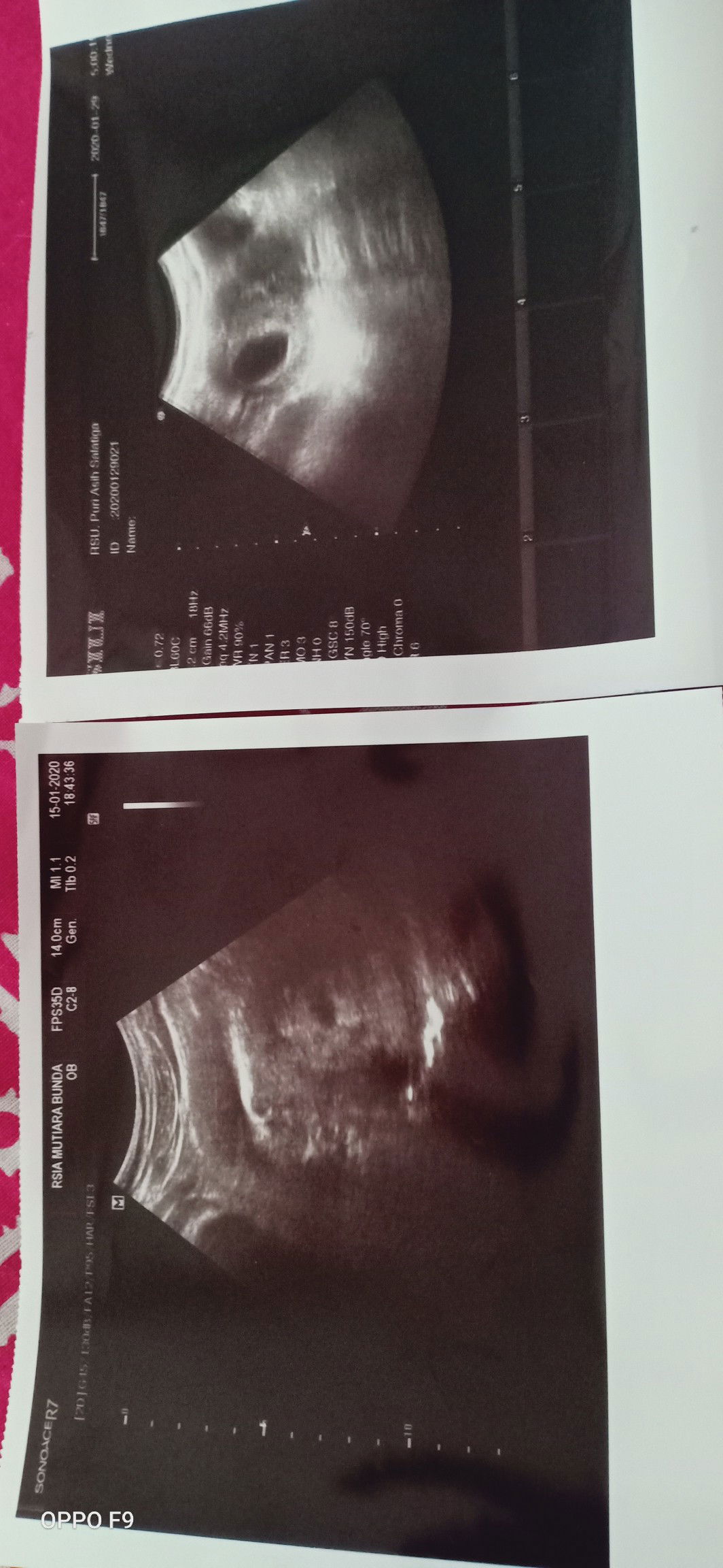 wajarkah 9w masih berupa kantong ?