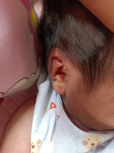 21วันหูน้องเป็นแบบนี้