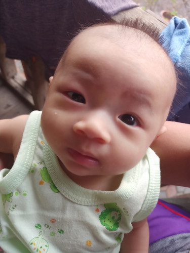 ตาแดงบวม