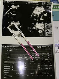 Nurul Asyifa Dewi profile icon