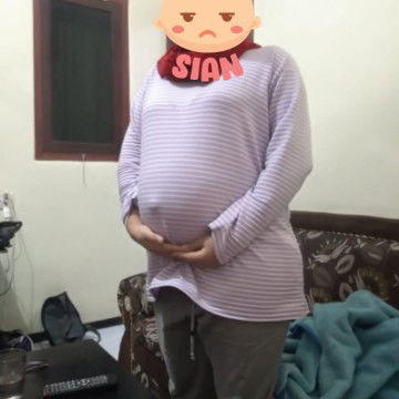 pusarku menonjol keluar