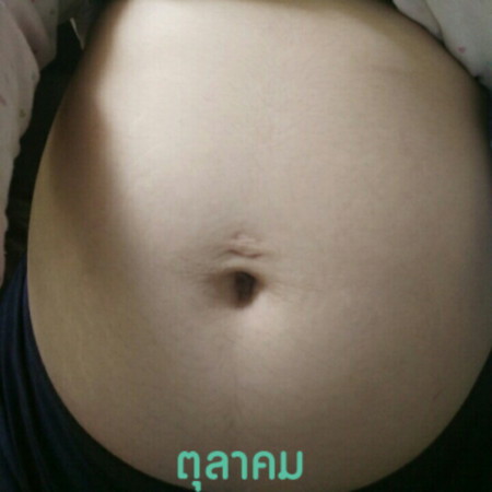 ท้องแบบนี้ผู้หญิงหรือผู้ชายค่ะ แม่ๆๆ