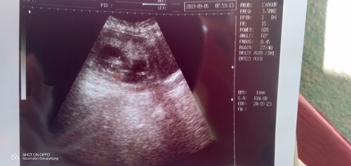 Pakai Minyak kayu putih