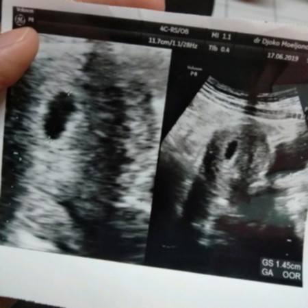 6w apakah masih kantong