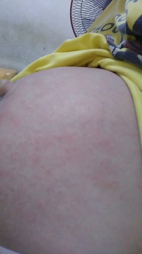 สอบถามค่ะ