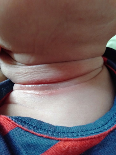 คอแดง