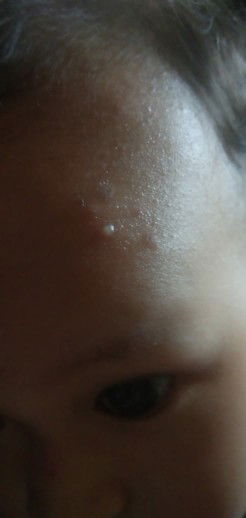 bintik berair warna pucat