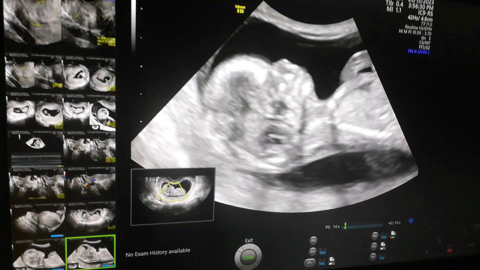 Boy or Girl profile icon