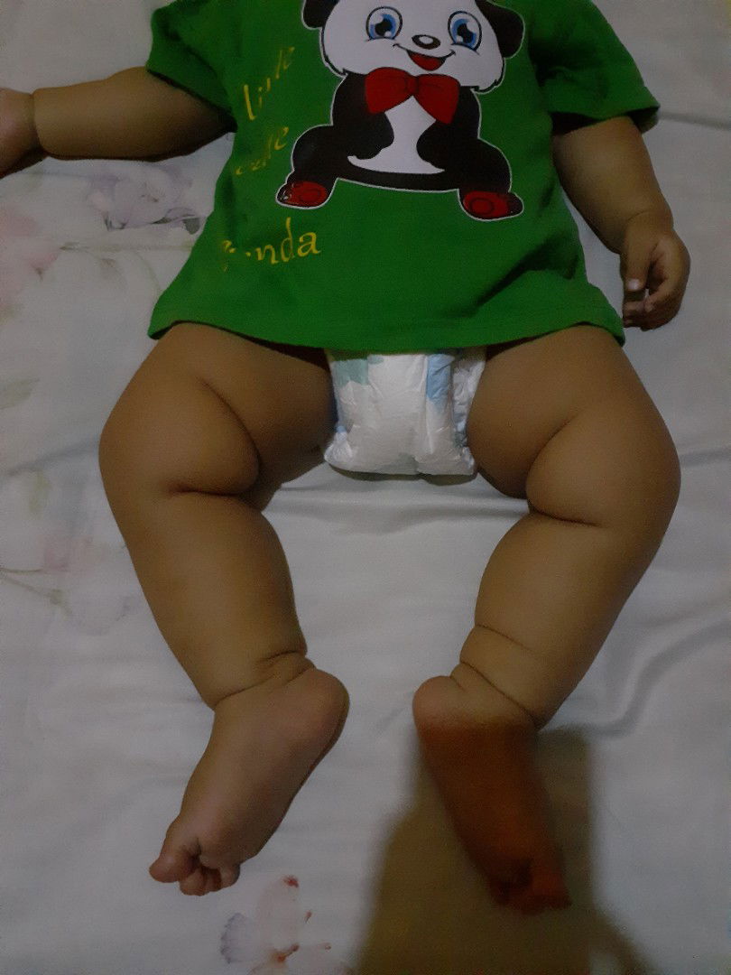 bentuk kaki bayi 6 bulan