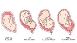 Placenta